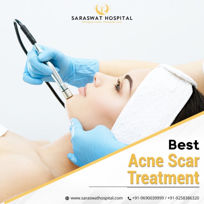 Which is the Best Acne Scar Treatment for a Patient?