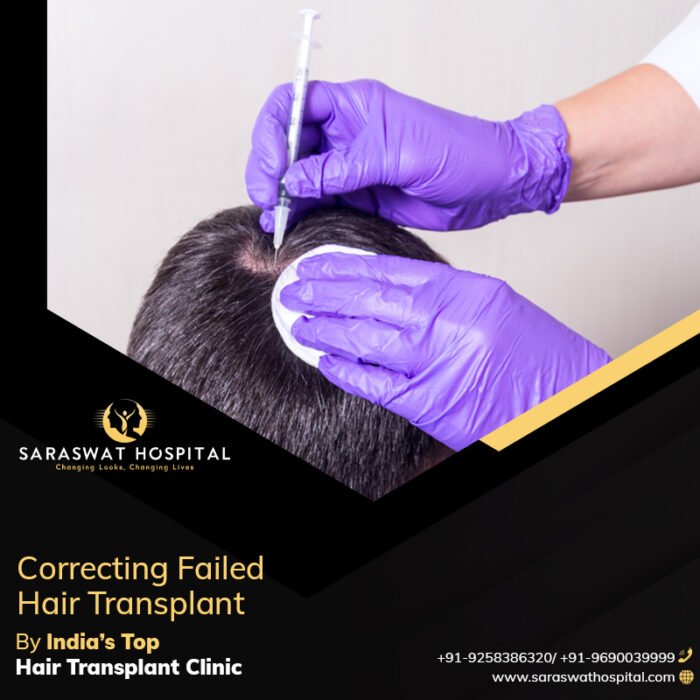 Hair Transplant Clinic in India Correct a Failed Hair Transplant