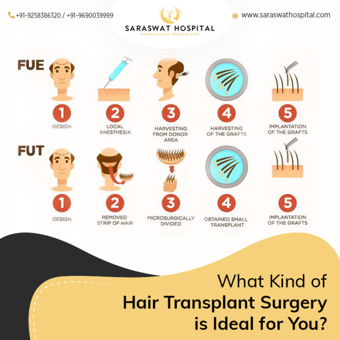 FUE vs FUT: Which Hair Transplant Surgery Should You Choose?