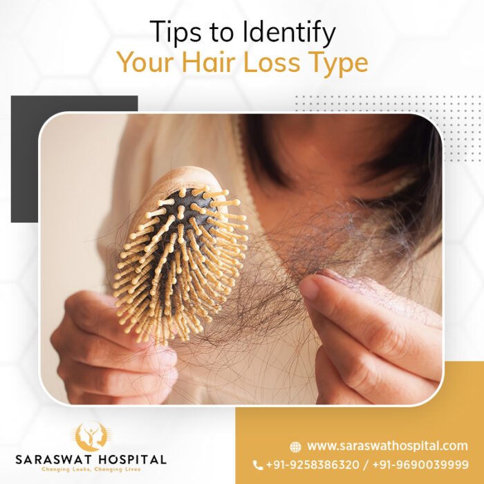 Hair Loss Types: Get the Best Hair Loss Treatment from Experts