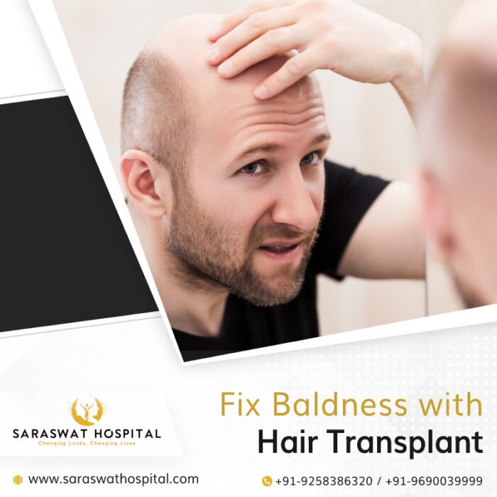 How a Hair Transplant Surgery Fixes Baldness?