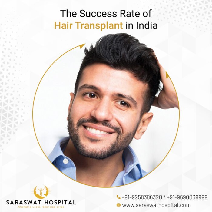What is the Success Rate of Hair Transplant?
