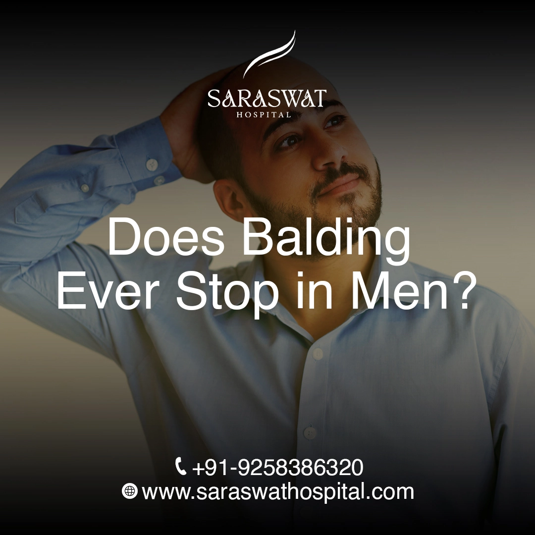 Does Balding Ever Stop in Men?