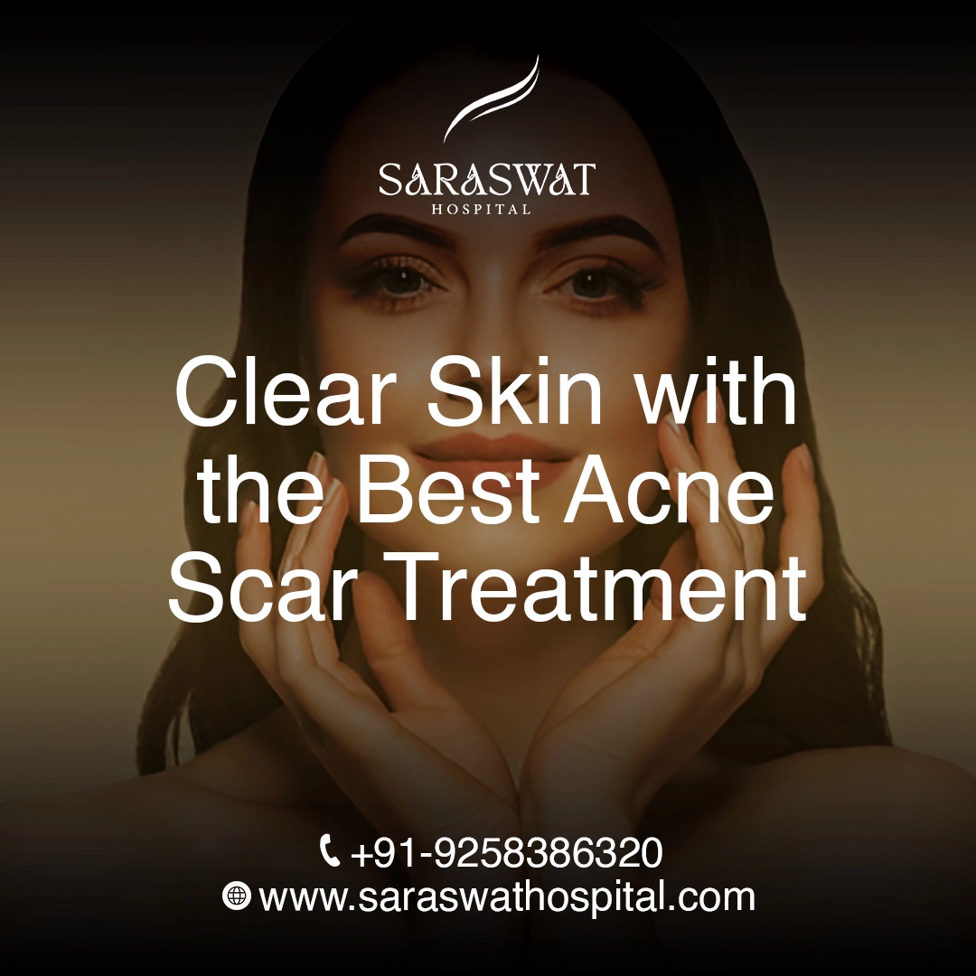 Effective Ways to Get Clear Skin with the Best Acne Scar Treatment