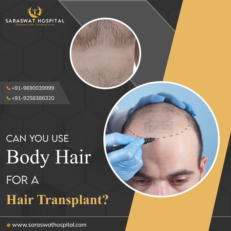 Can Body Hair Be Used for A Hair Transplant Procedure?