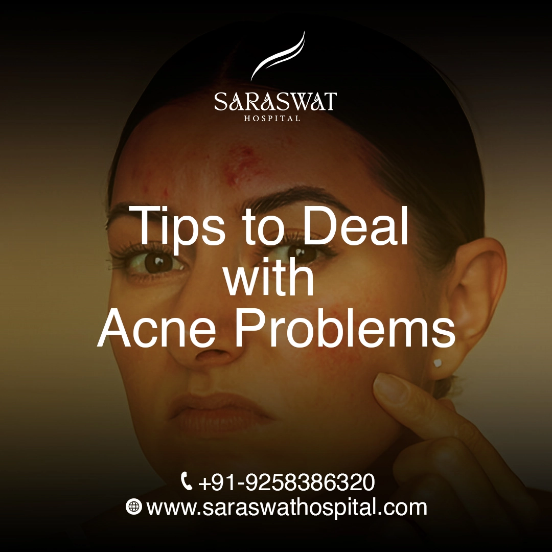 Top 10 Tips to Deal with Acne Problems in Summer