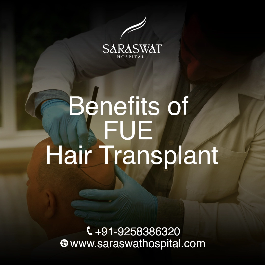 What are the Benefits of FUE Hair Transplant?