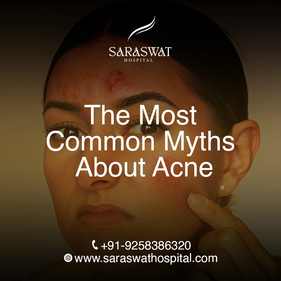 Busting the Most Common Myths About Acne