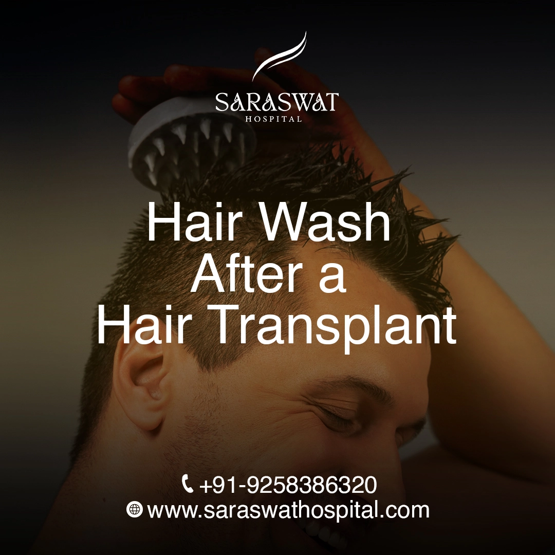How Soon Can I Do a Hair Wash After Hair Transplant?