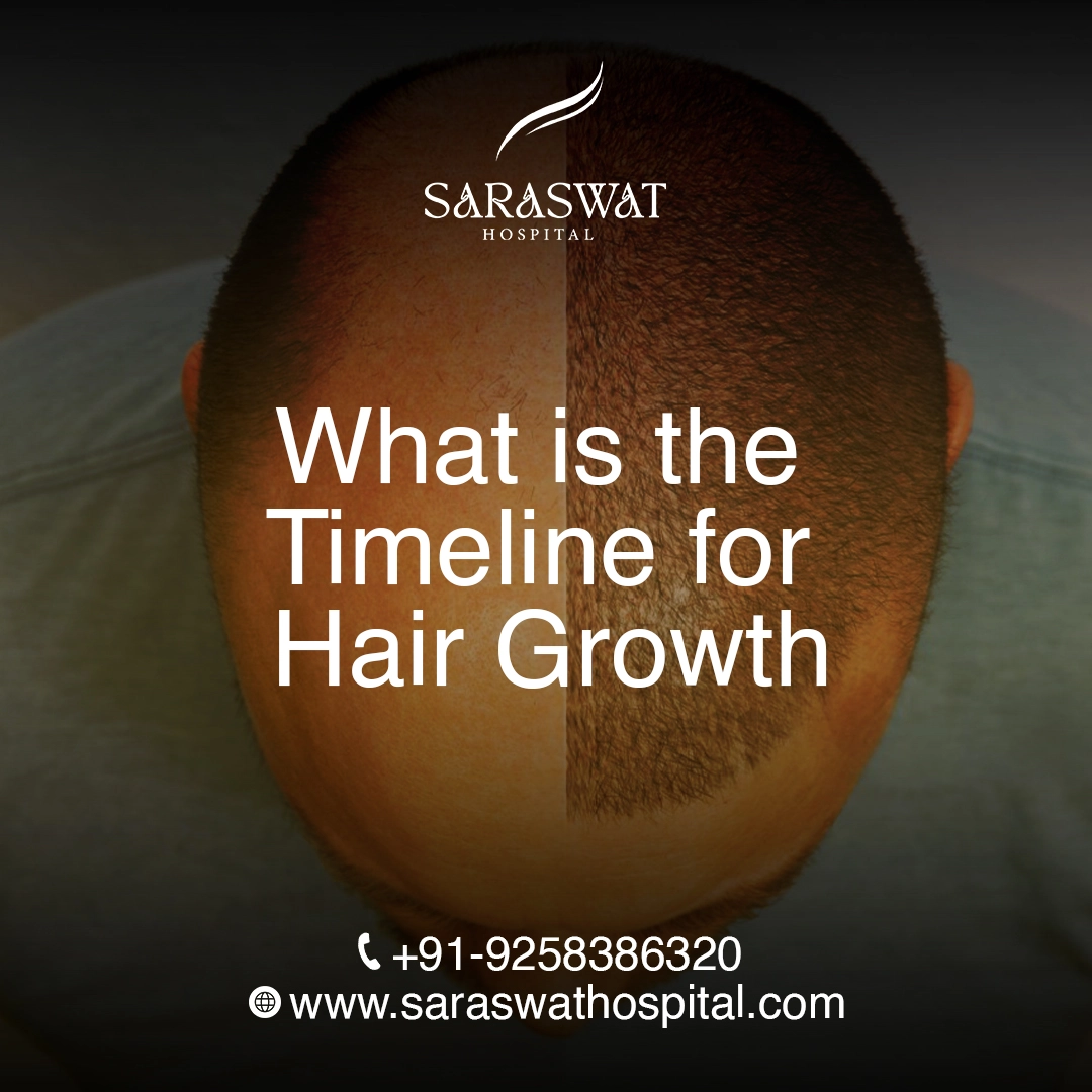 What is the Timeline for Hair Growth After Hair Transplant?