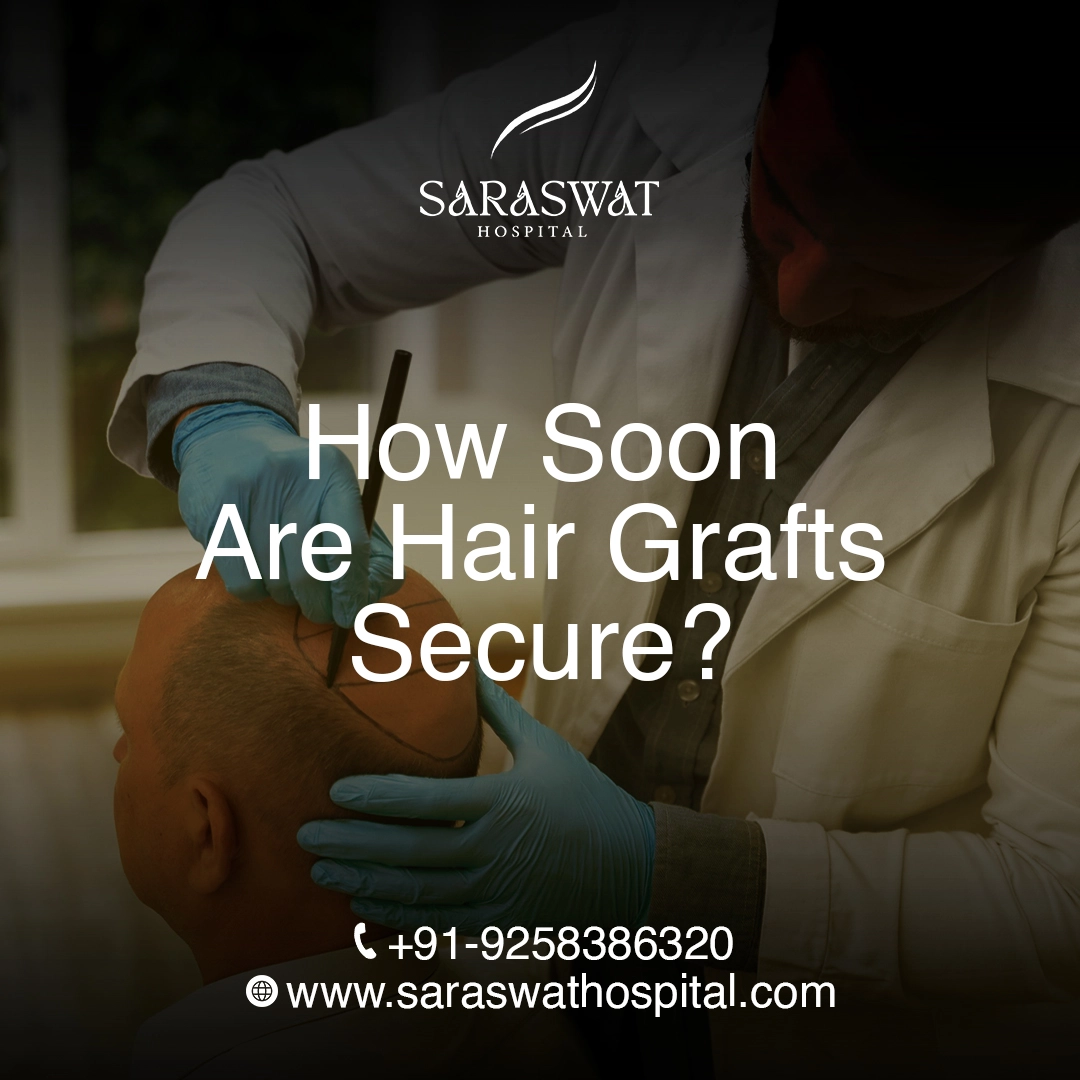 How Soon Are Hair Grafts Secure After a Hair Transplant?