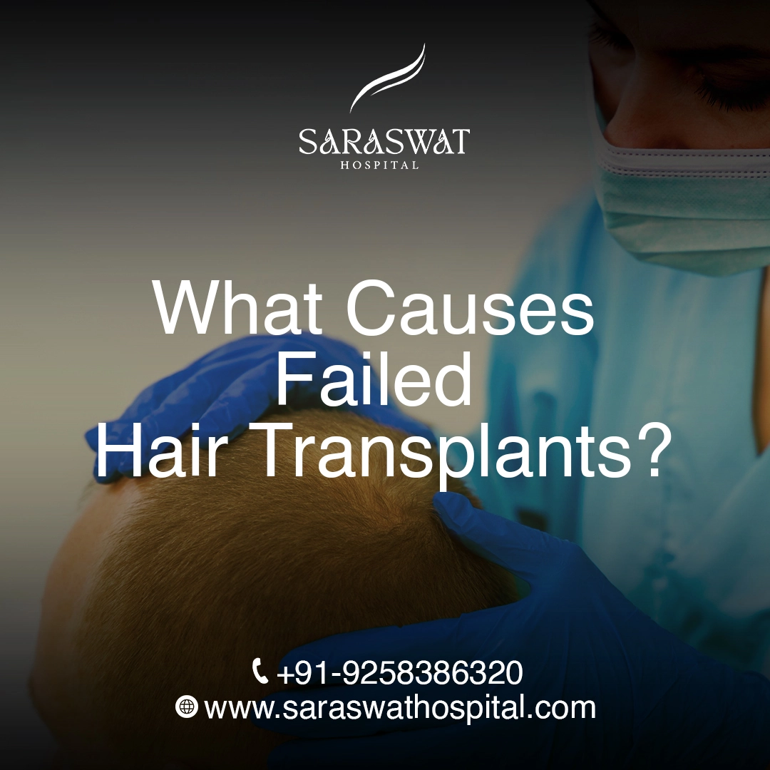 What Causes Failed Hair Transplants? | Saraswat Hospital
