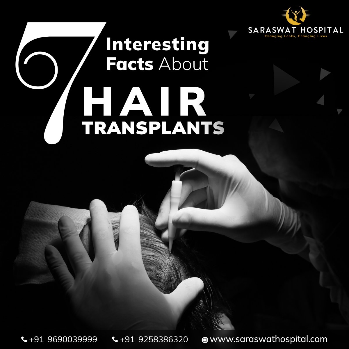 7 Interesting Hair Transplant Facts