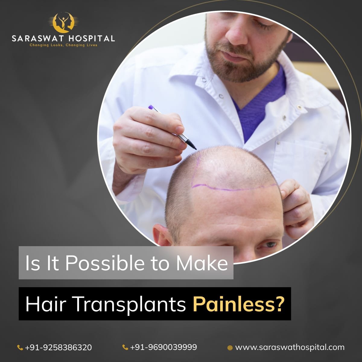 Is It Possible to Make Hair Transplants Completely Comfortable?