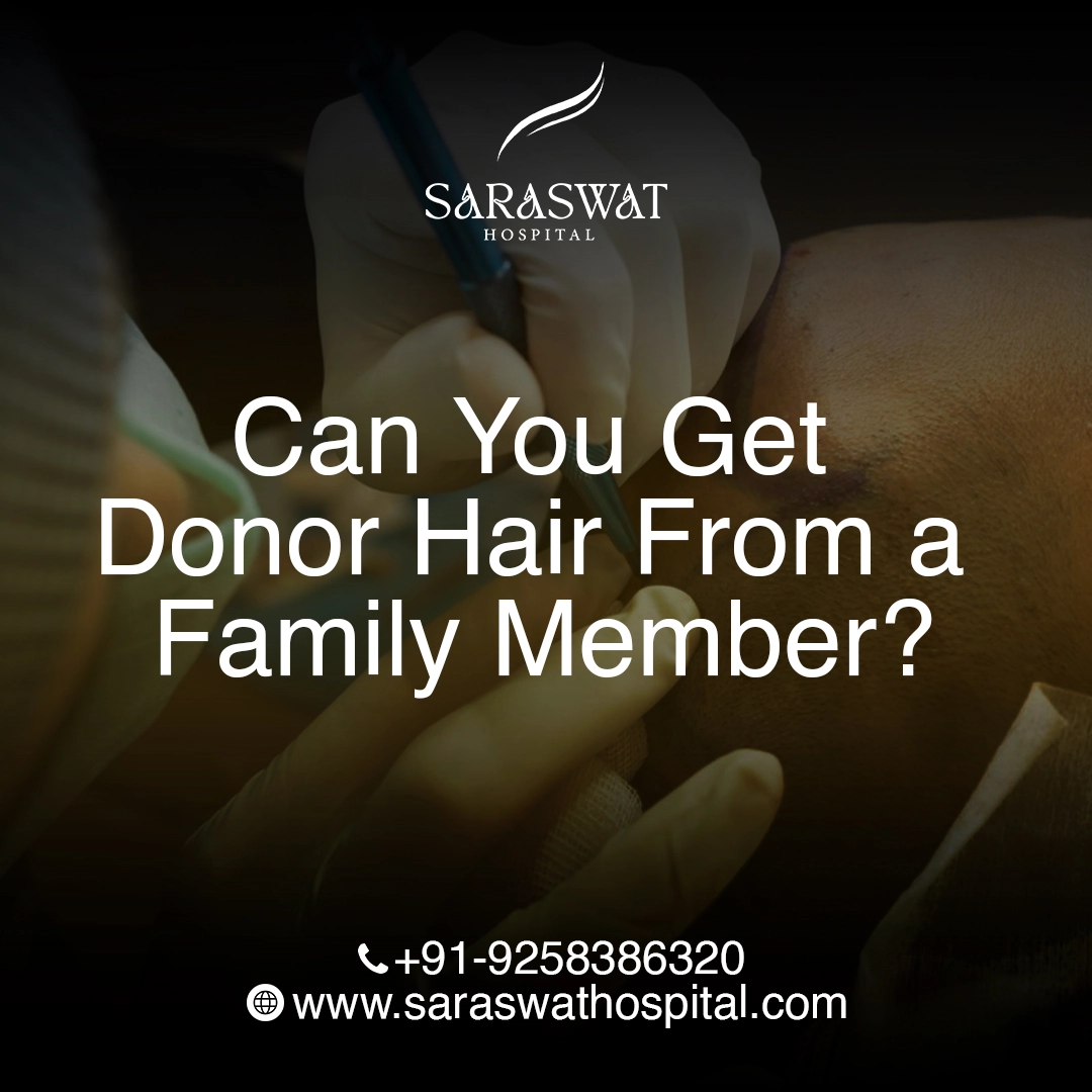 Can You Get Donor Hair From a Family Member?