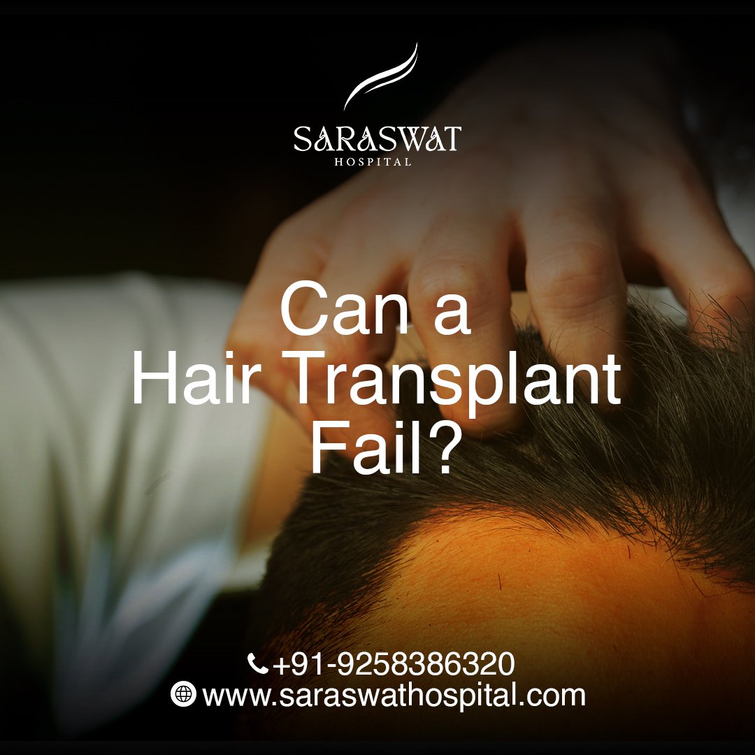Can a Hair Transplant Fail?