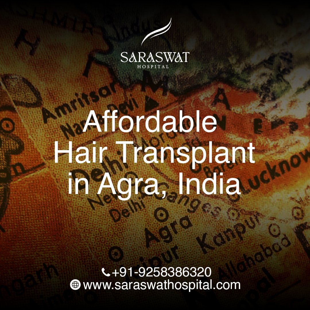 Unlocking the Secret: Affordable Hair Transplant Cost in Agra