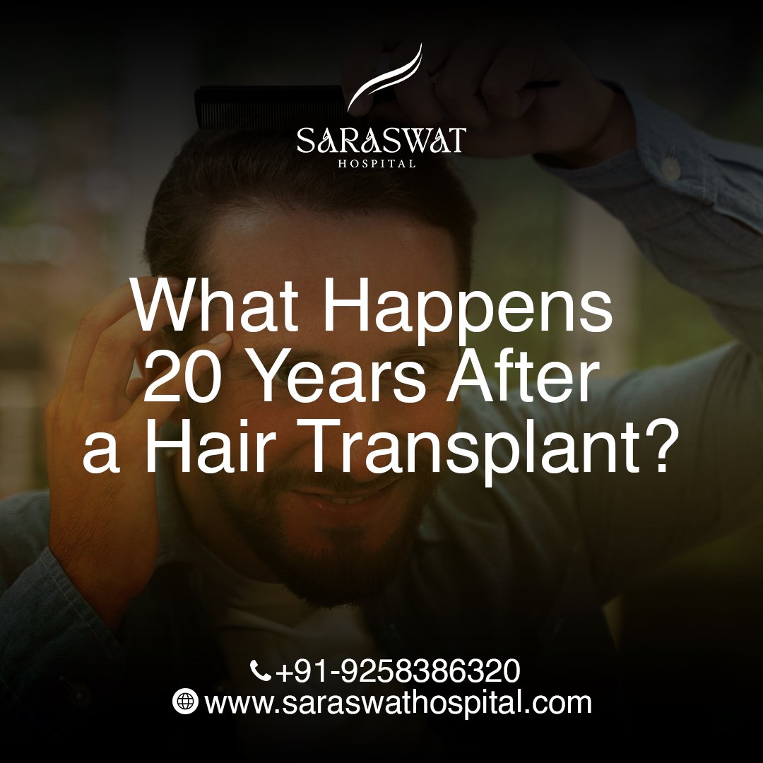 What Happens 20 Years After a Hair Transplant