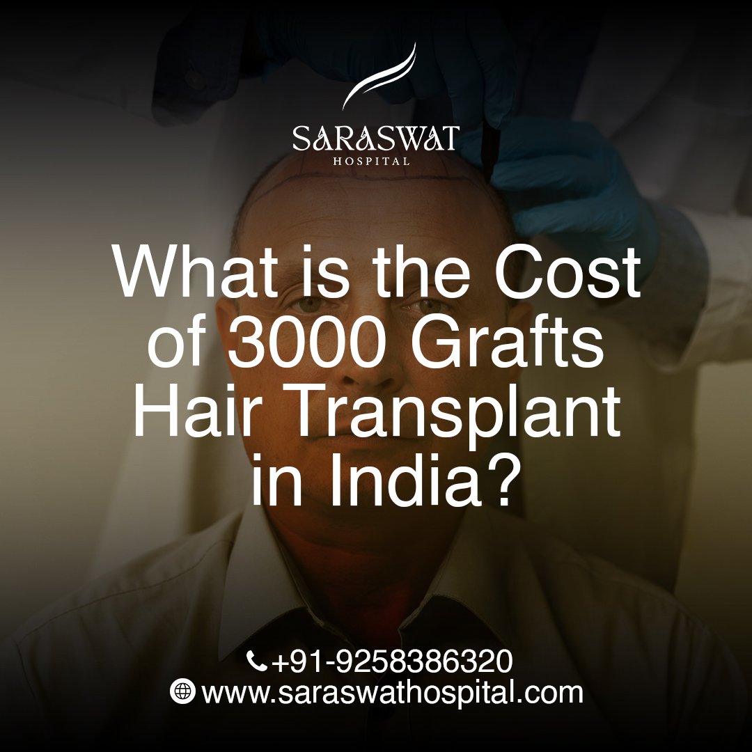 What is the Cost of 3000 Grafts Hair Transplant in India