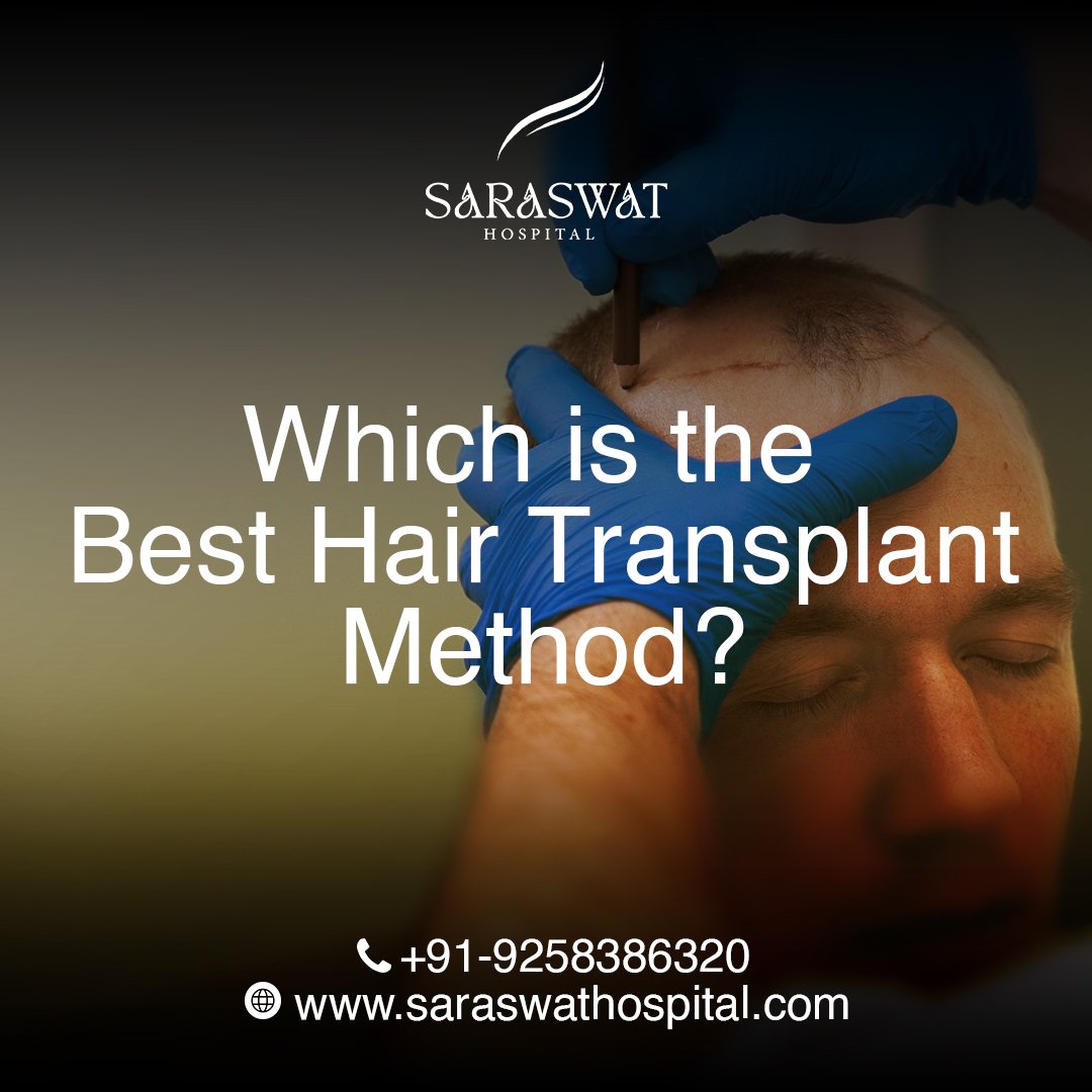 Best Hair Transplant Method