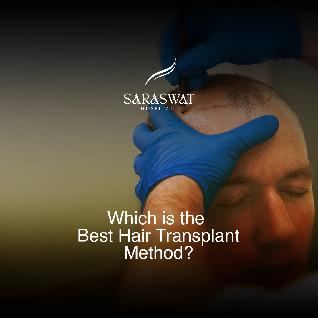 Best Hair Transplant Method