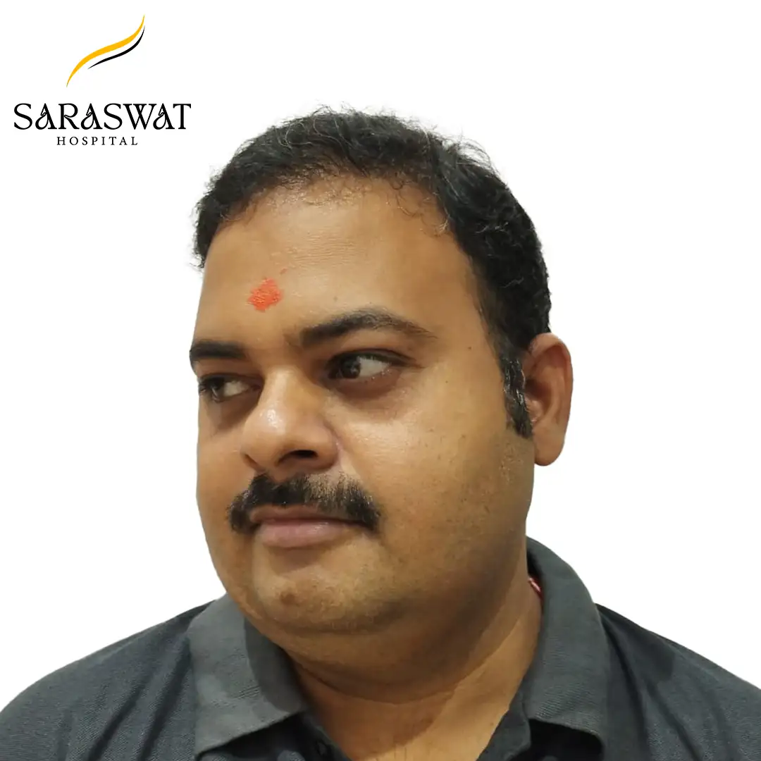 45 Degree Left FUE Hair Transplant Result After Procedure