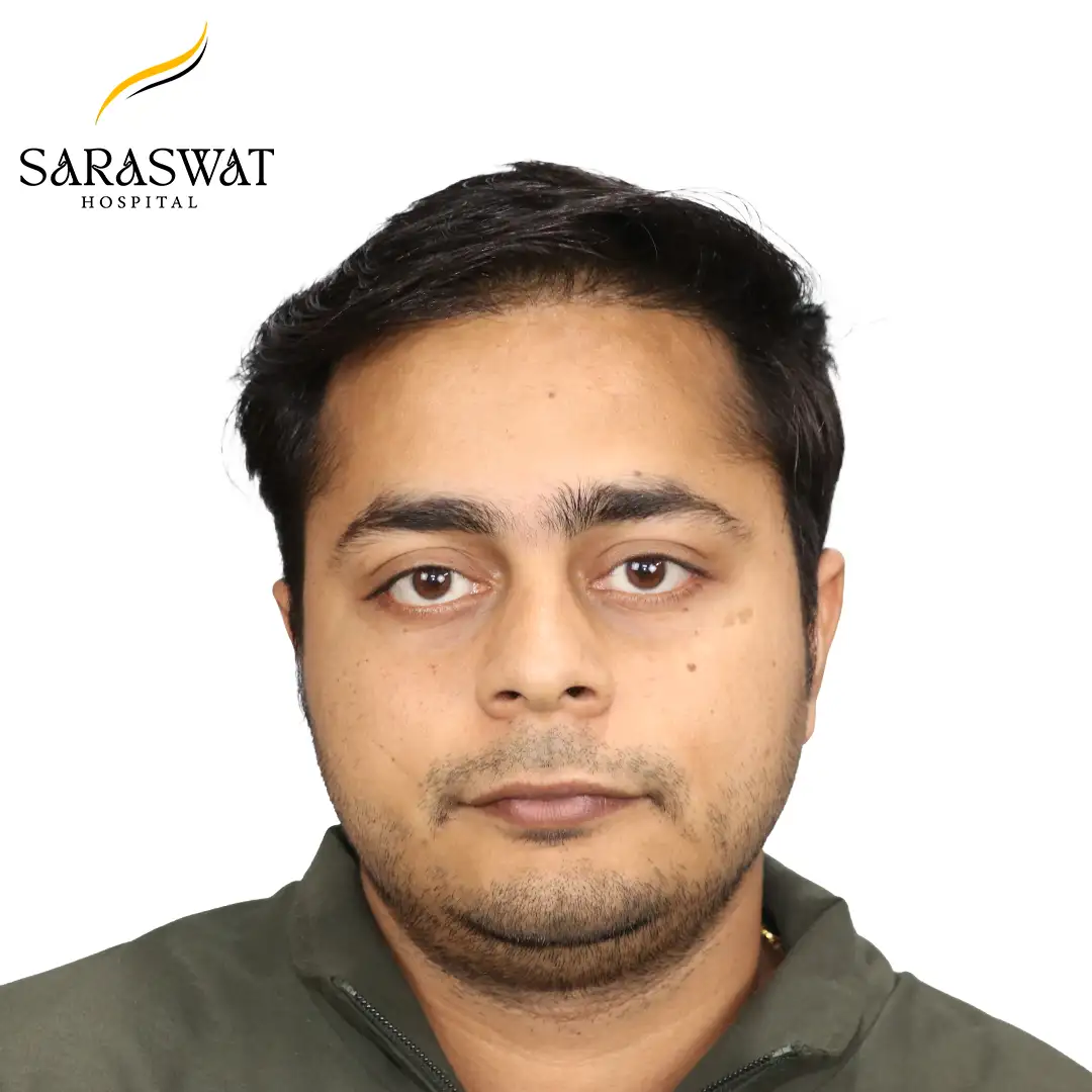 Hair Transplant Before and After