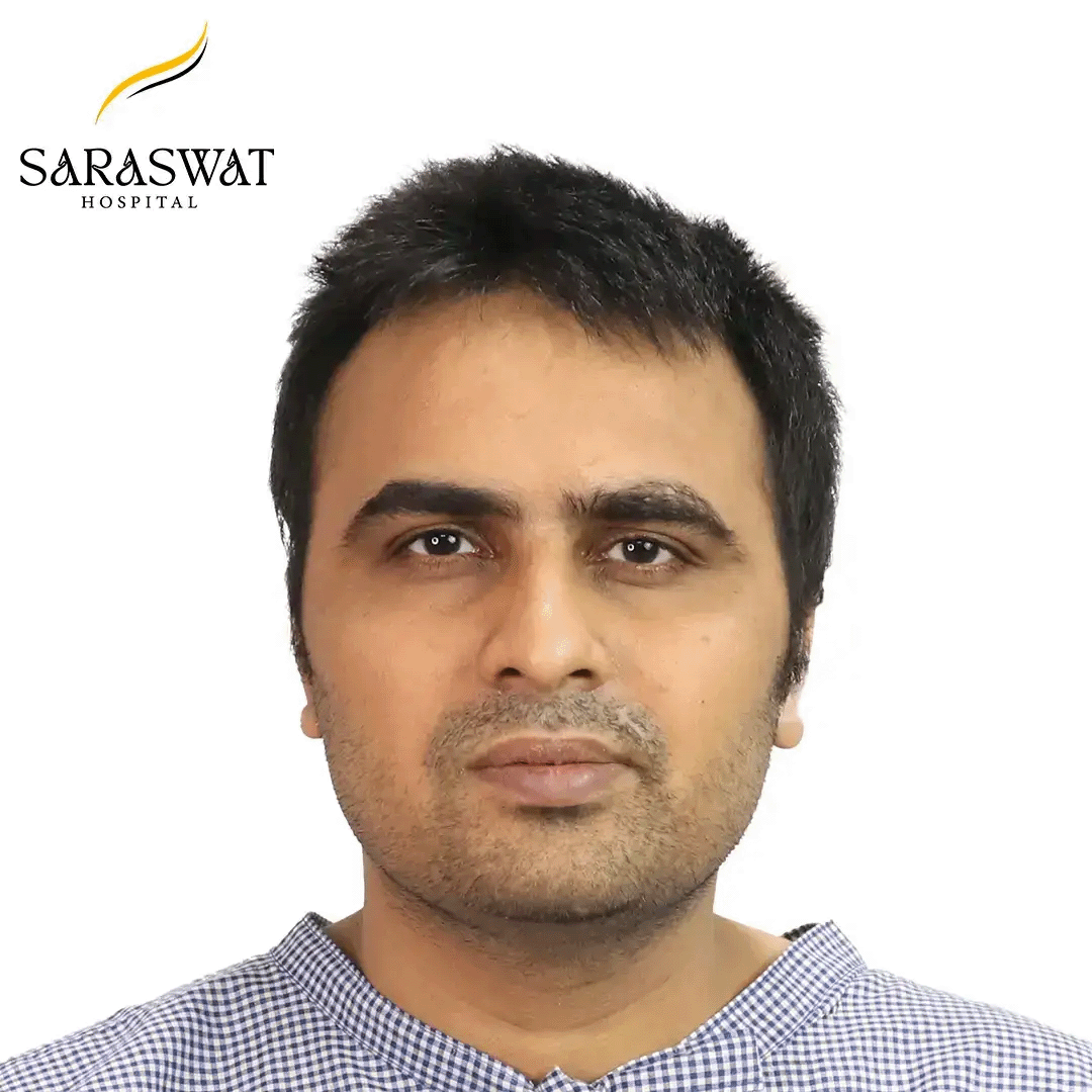 Hair Transplant Before and After Results