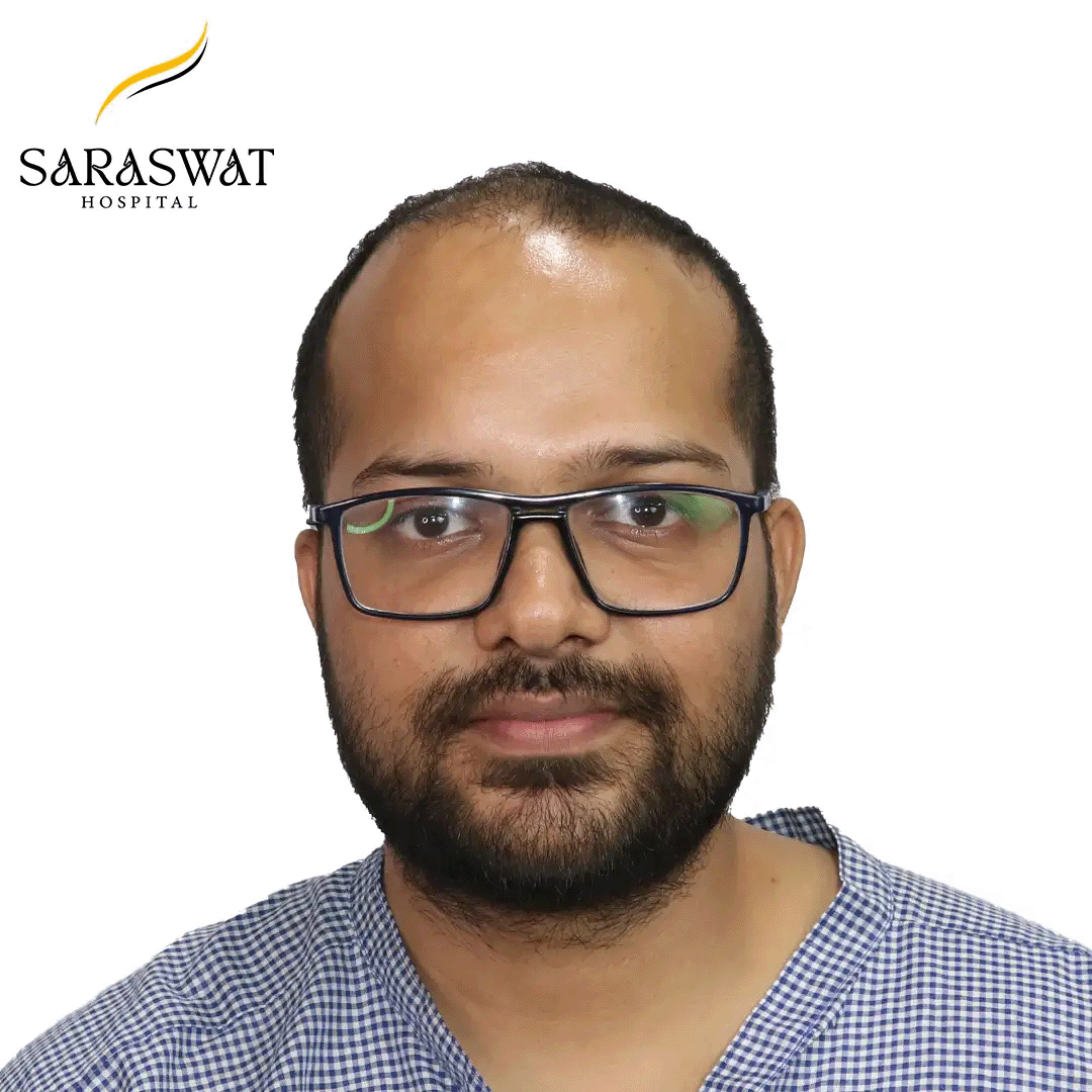 Hair Transplant Before and After Results