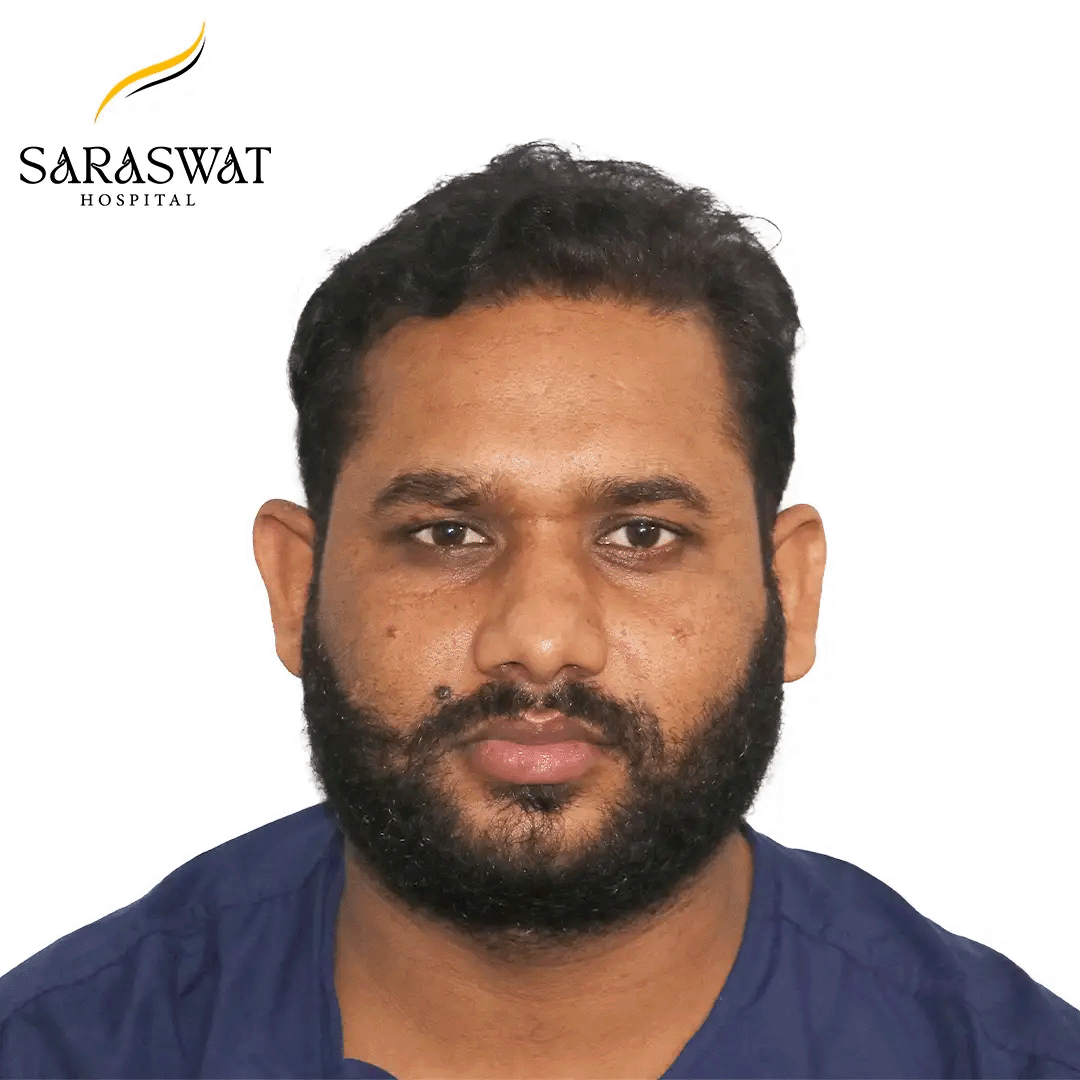 Hair Transplant Before and After Results