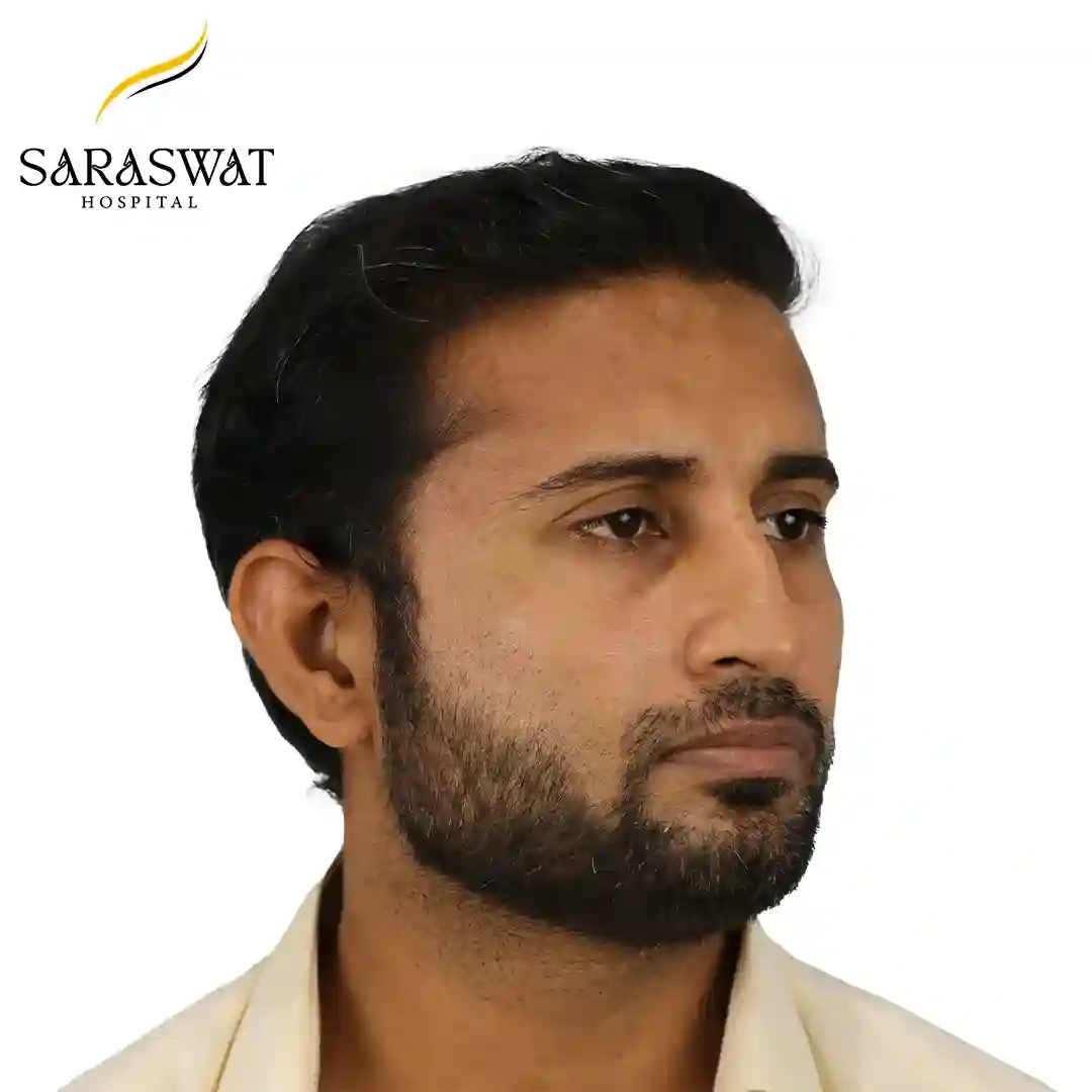 Best Hair Transplant Clinic in India | Saraswat Hospital