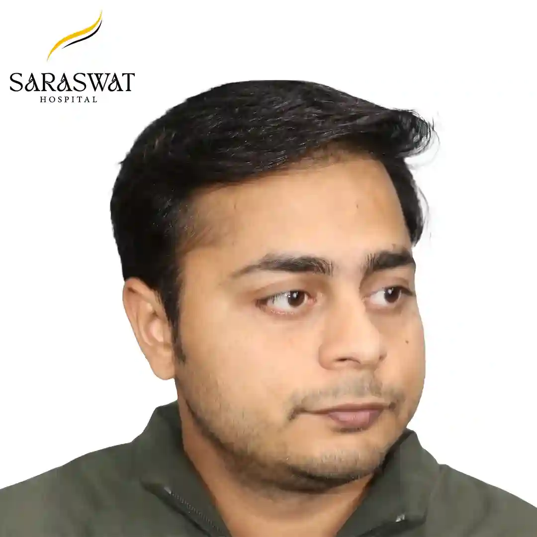 Hair Transplant Before After