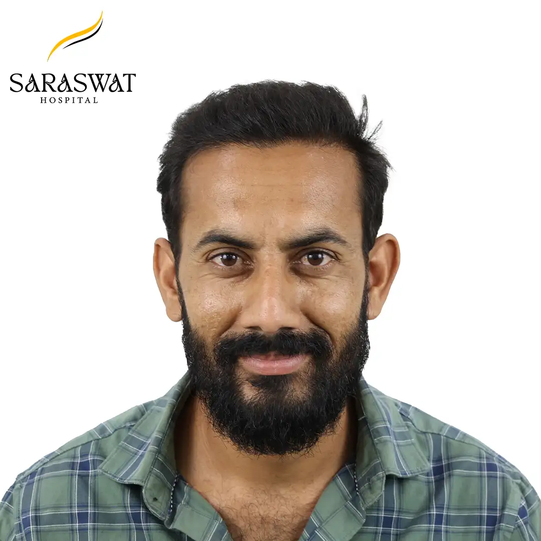 Hair Transplant Before and After Results