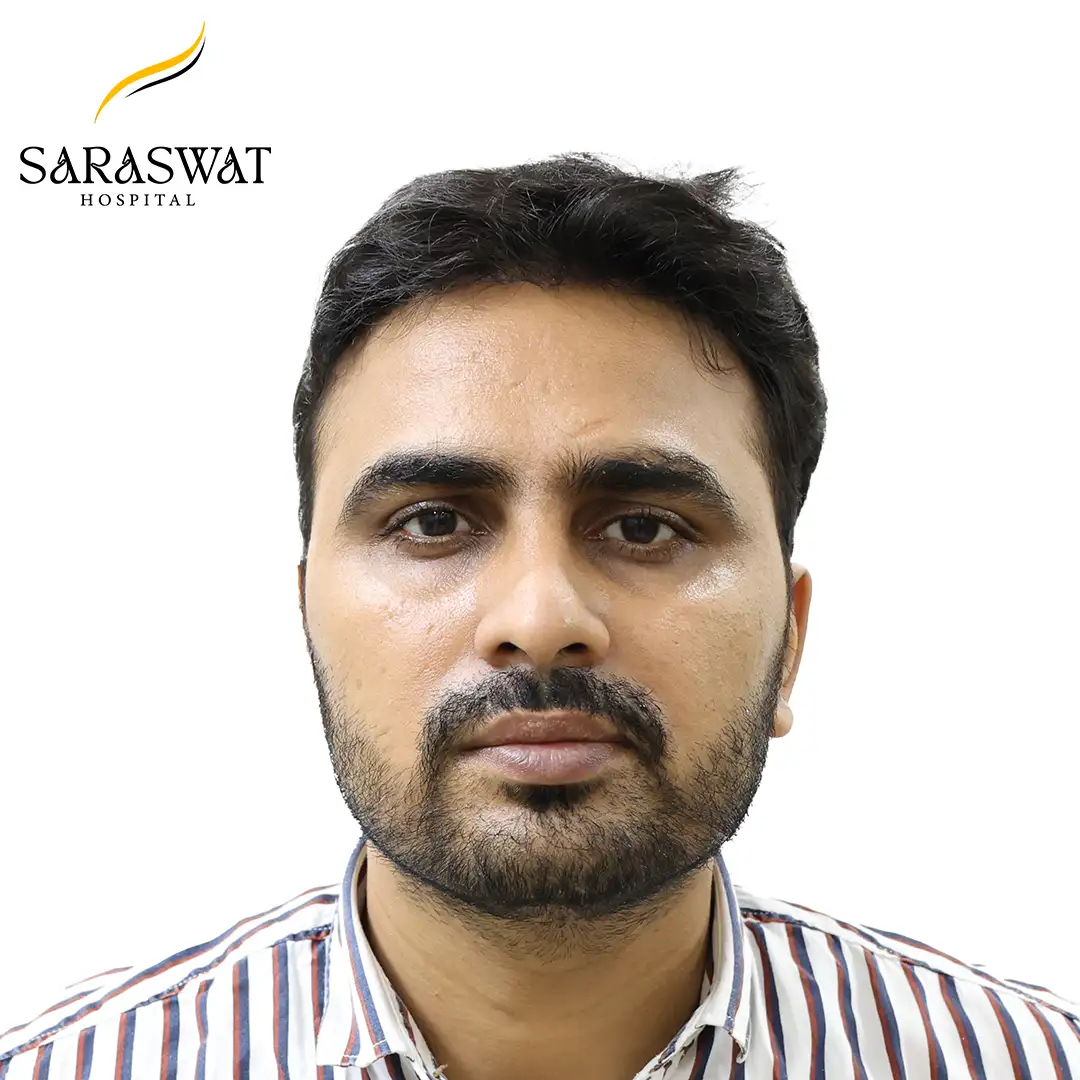 Front FUE Hair Transplant Result After Procedure