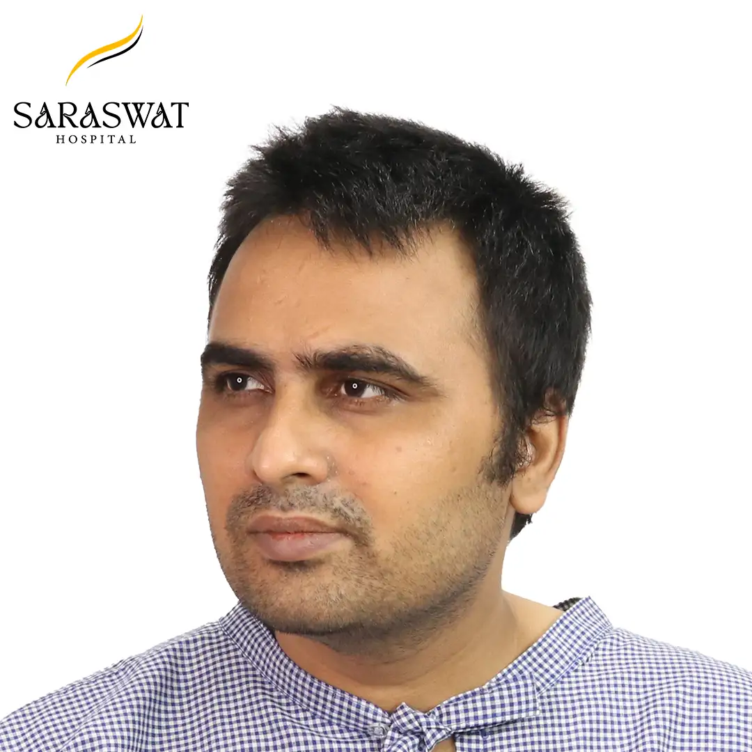 45 Degree Left FUE Hair Transplant Result Before Procedure