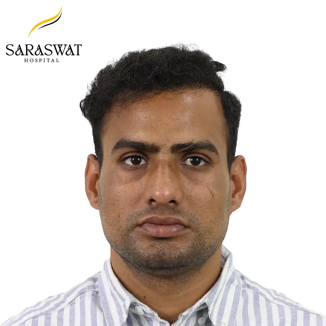 Hair Transplant Before and After