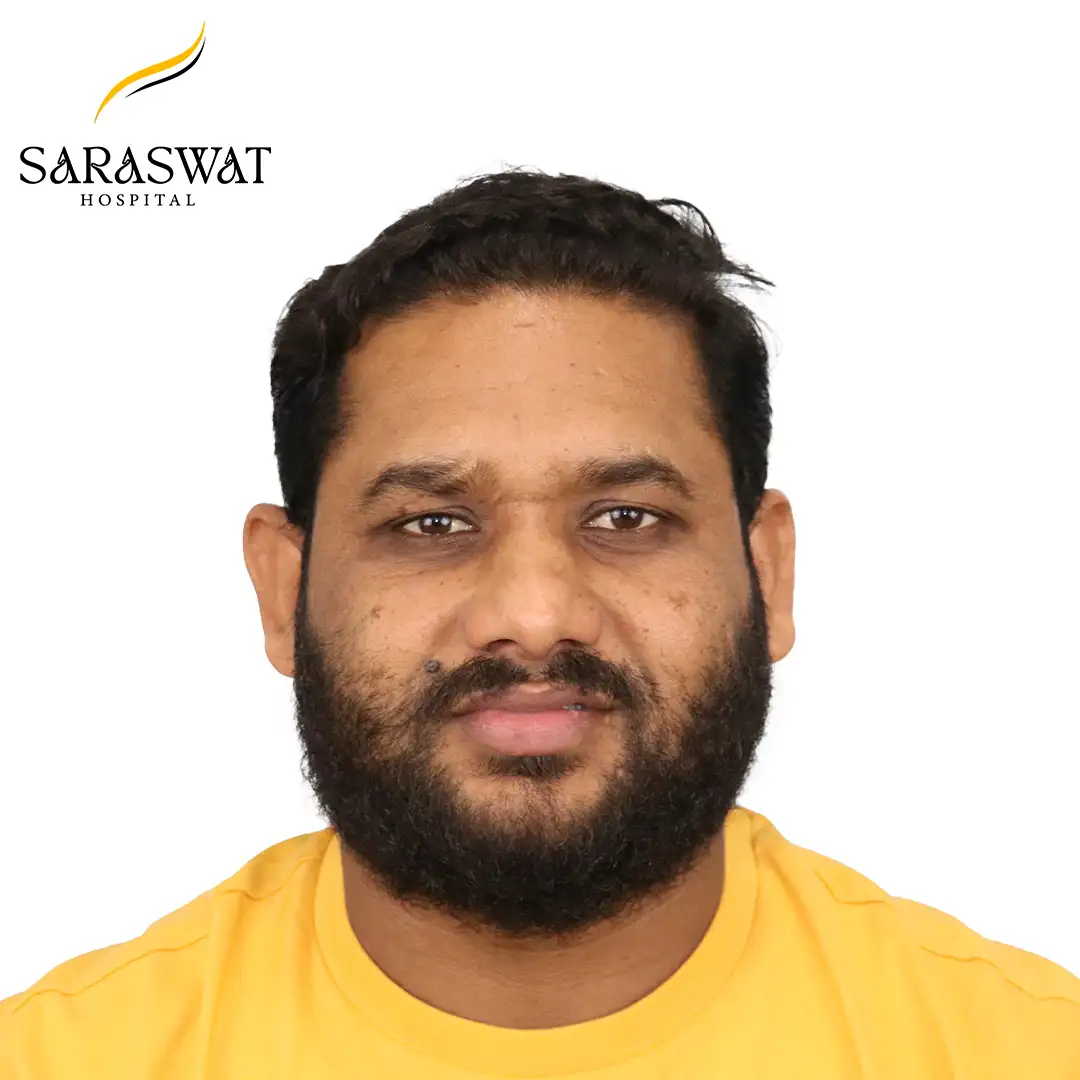 Front FUE Hair Transplant Result After Procedure