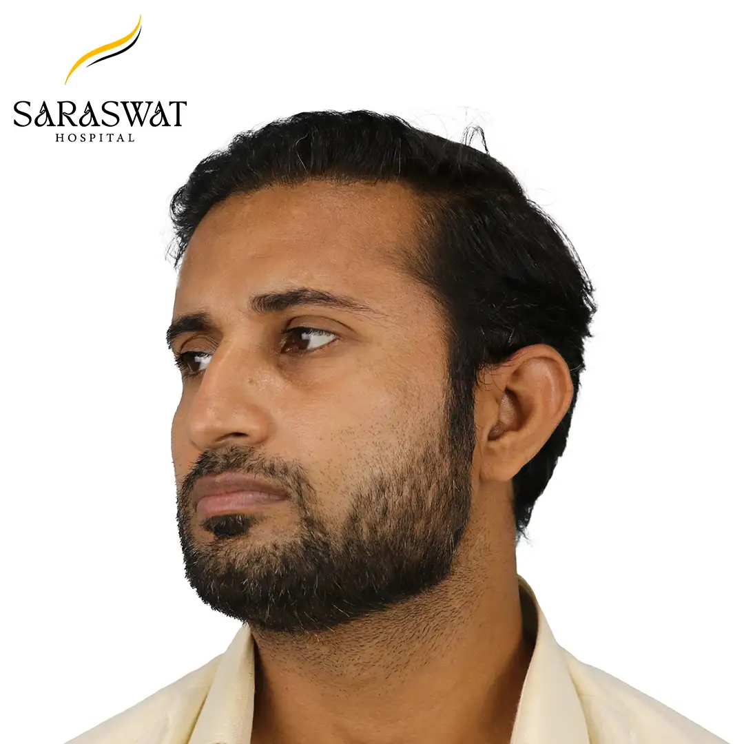Best Hair Transplant Clinic in India