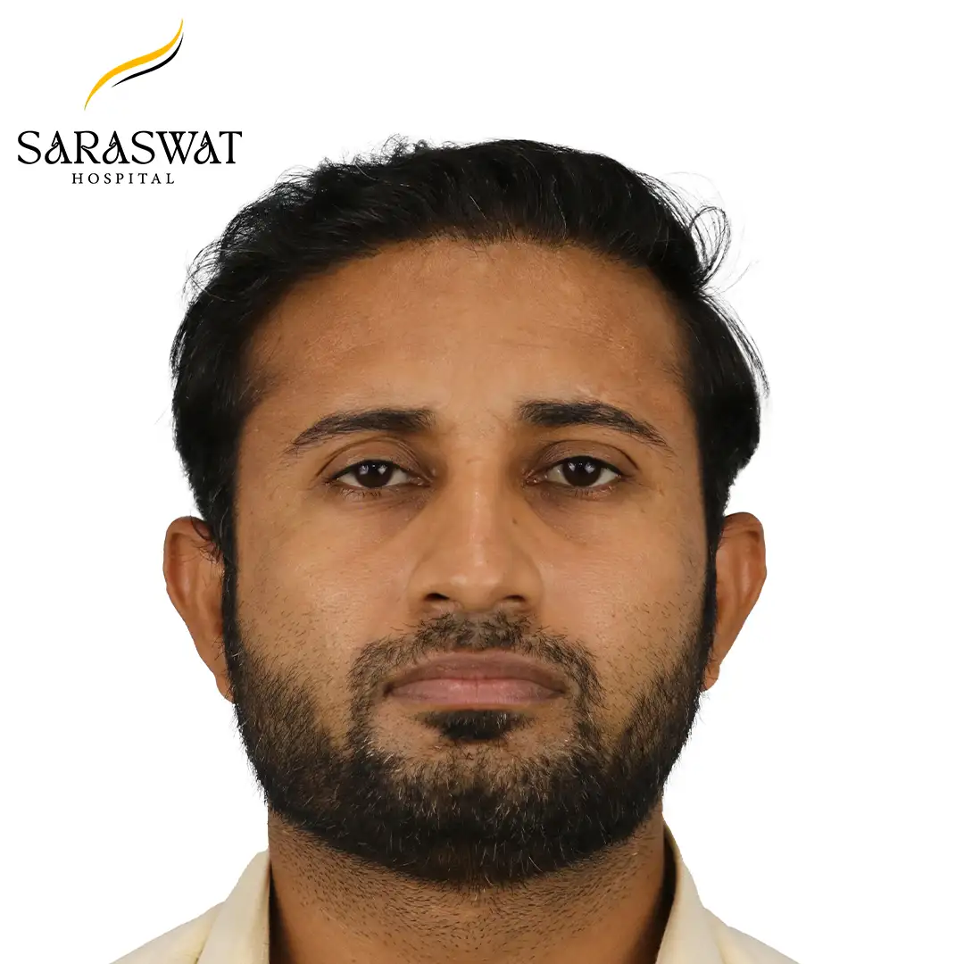 Hair Transplant Cost in India