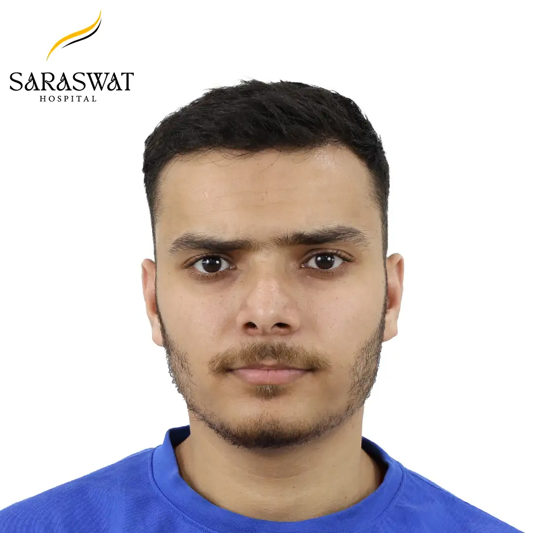 Front FUE Hair Transplant Result After Procedure