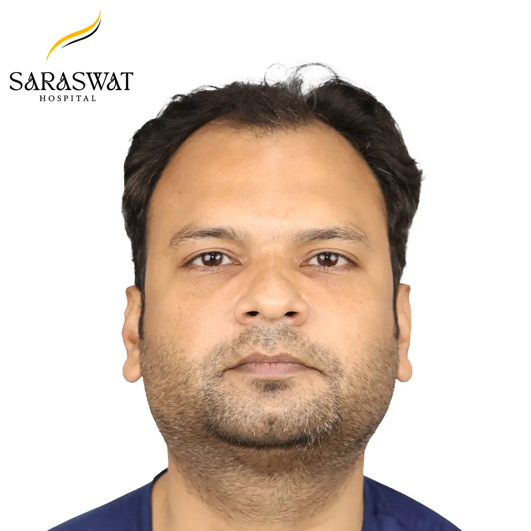 Hair Transplant Before and After Results