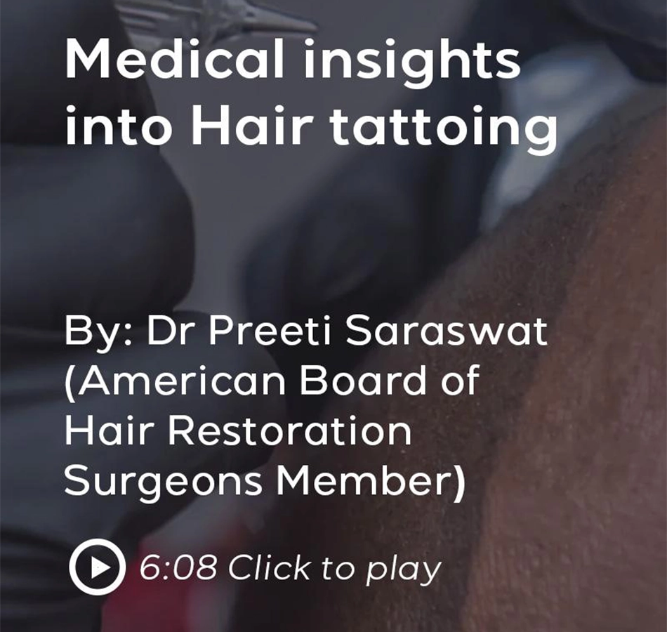 Scalp Micropigmentation in India By Expert ABHRS-Certified Surgeons