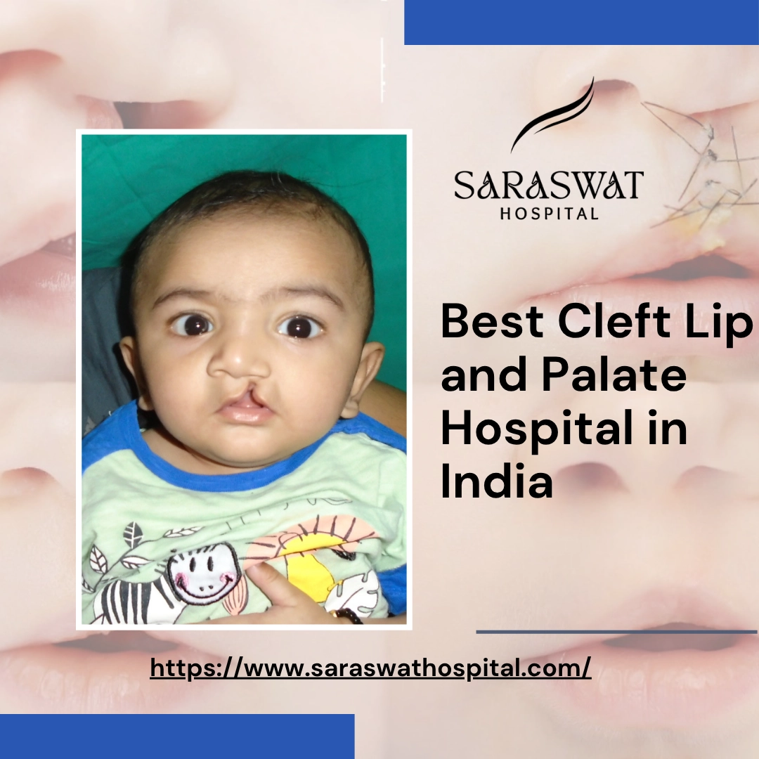 Which is the Best Cleft Lip and Palate Hospital in India?