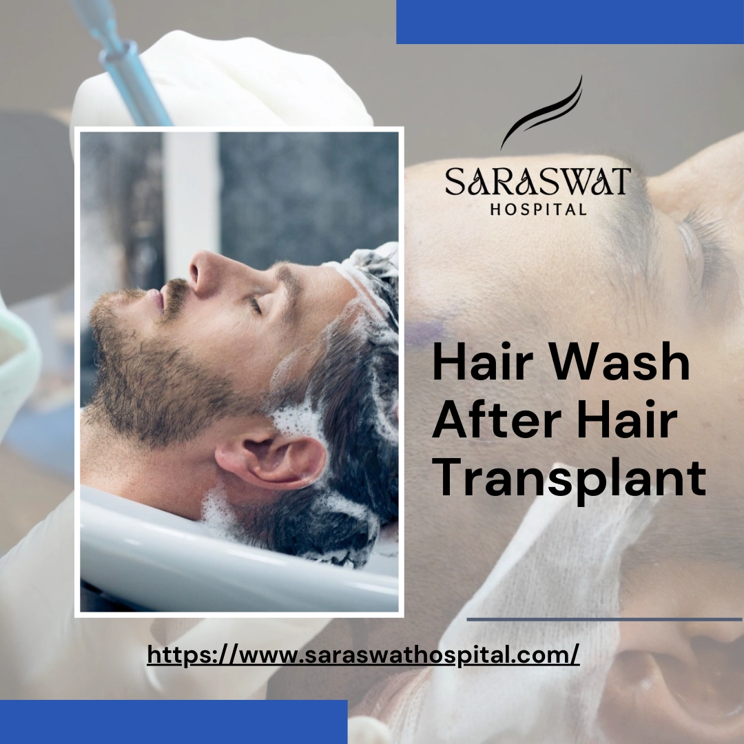 Hair Wash After Hair Transplant: Essential Tips and Techniques
