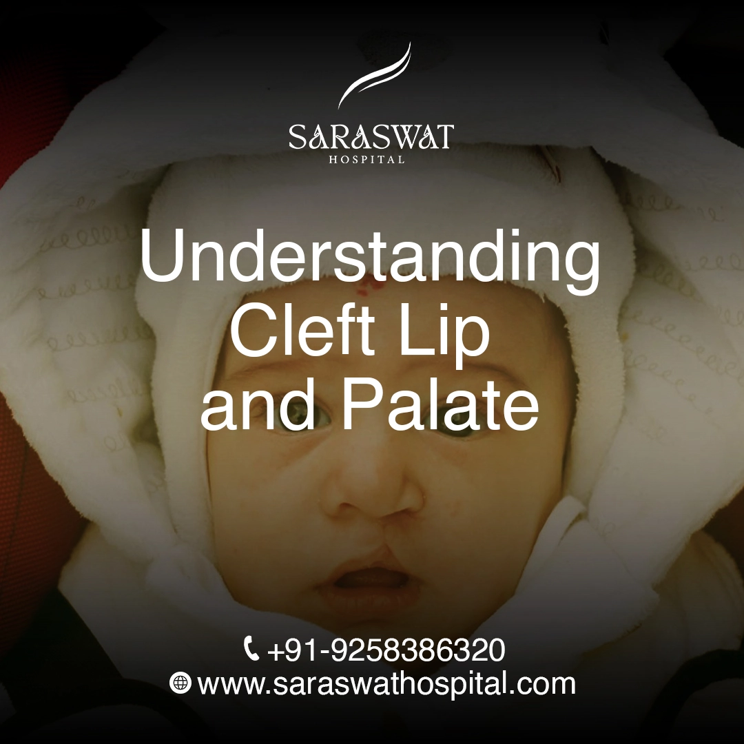 Cleft Lip and Cleft Palate: Causes, Symptoms | Free Treatment