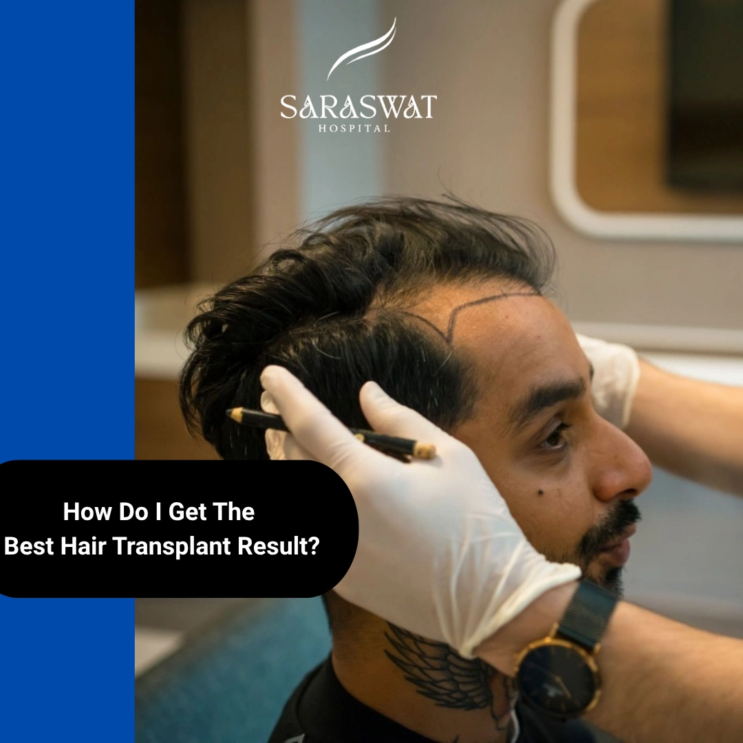 How Do I Get The Best Hair Transplant Result? - Key Takeaways