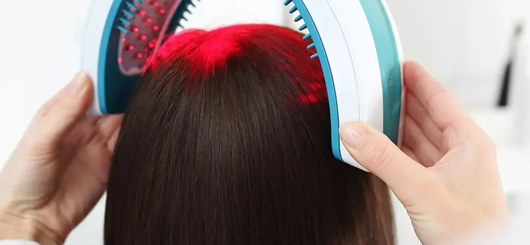 Low-Level Laser Therapy For Hair Loss in Agra | Benefits & Cost
