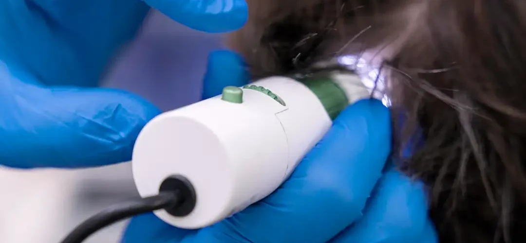 Low-Level Laser Therapy