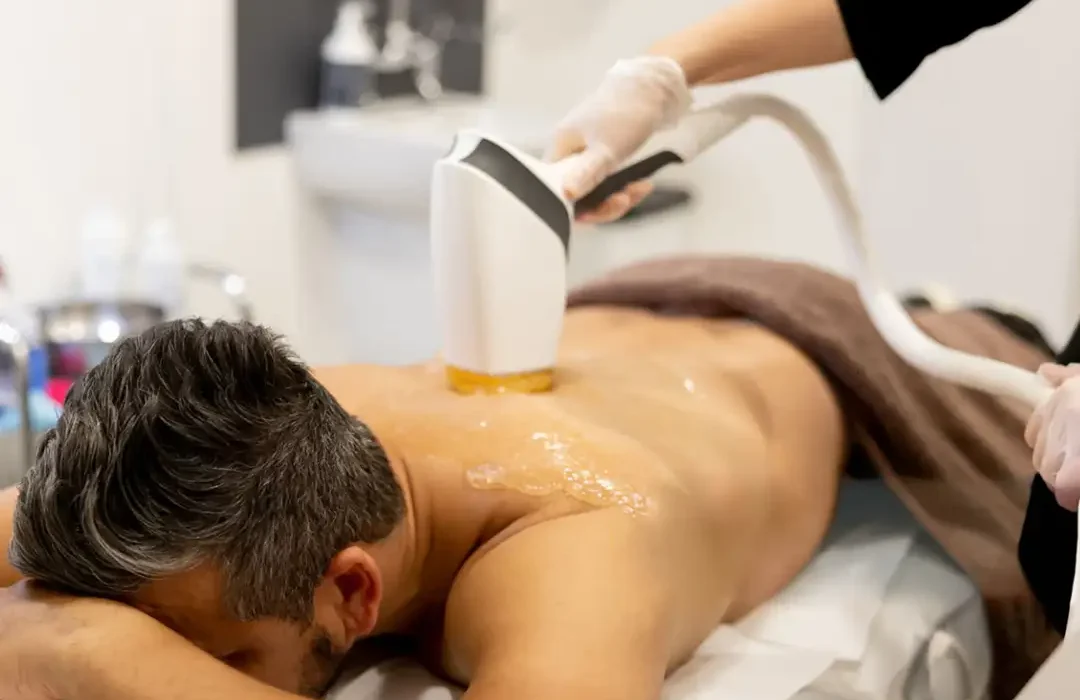 Laser Hair Removal: How it Works, Benefits, Cost, Results & More