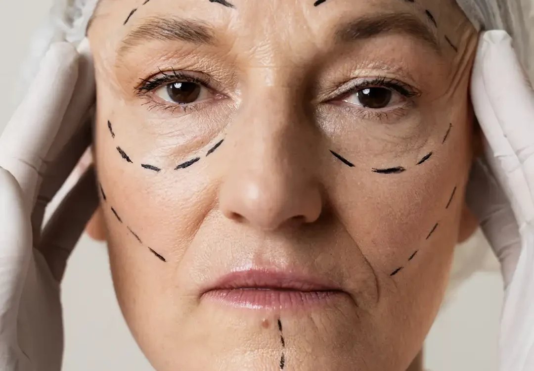 Best Plastic Surgery in India - Top Cosmetic Surgery Specialist